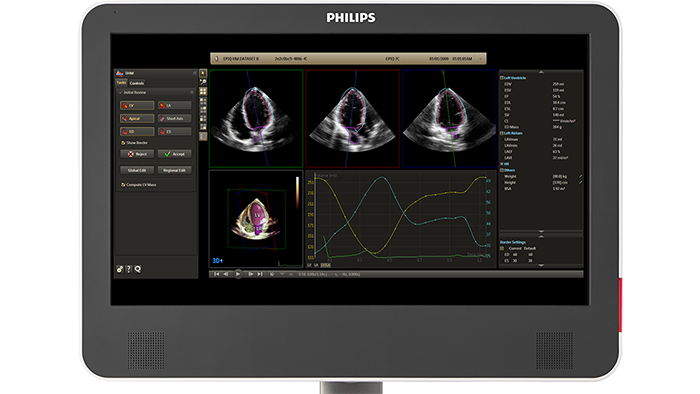  Dynamic HeartModel A.I. - 1