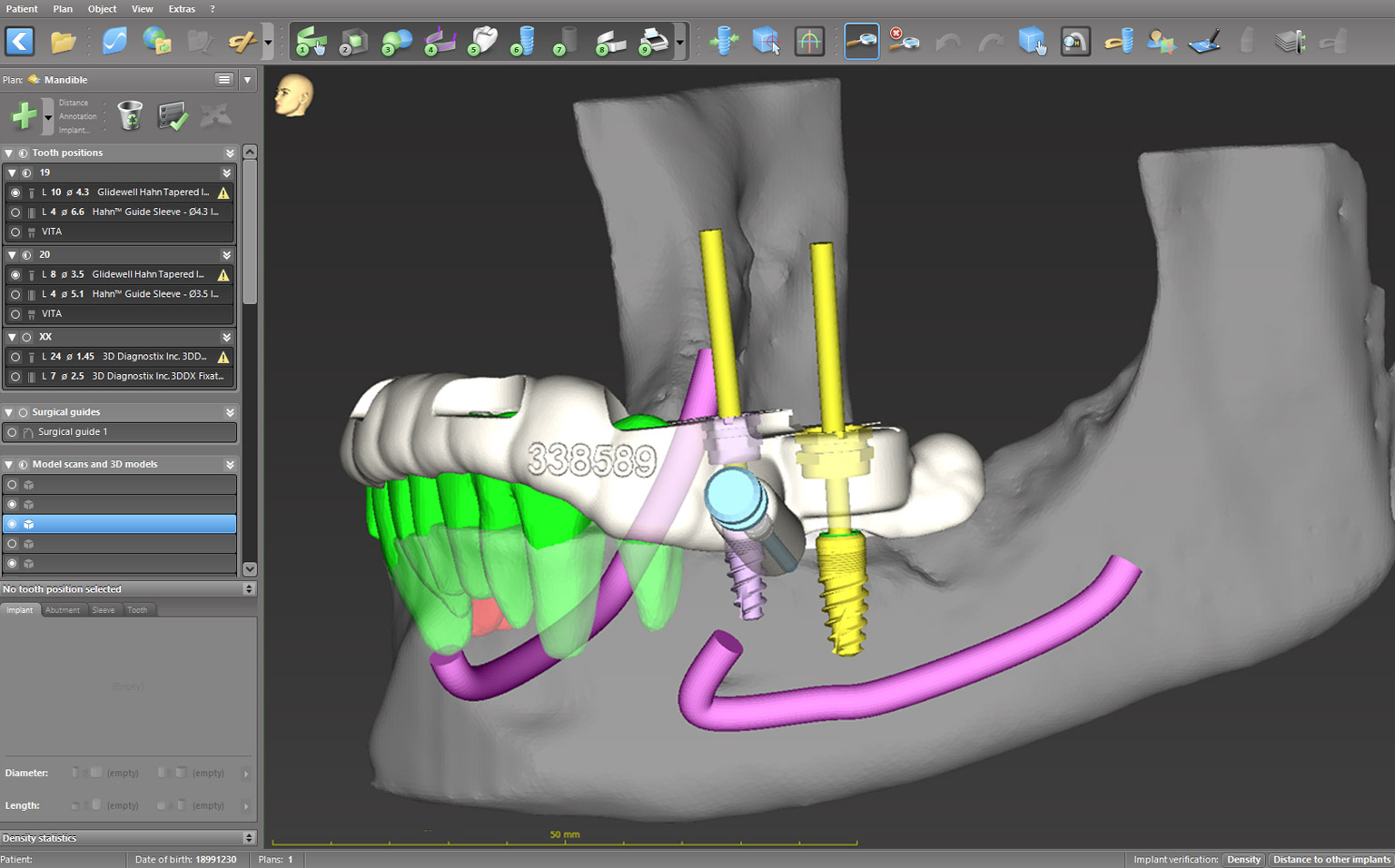 Metaverse Dentistry: Integrating Virtual Reality into Oral Care - 04