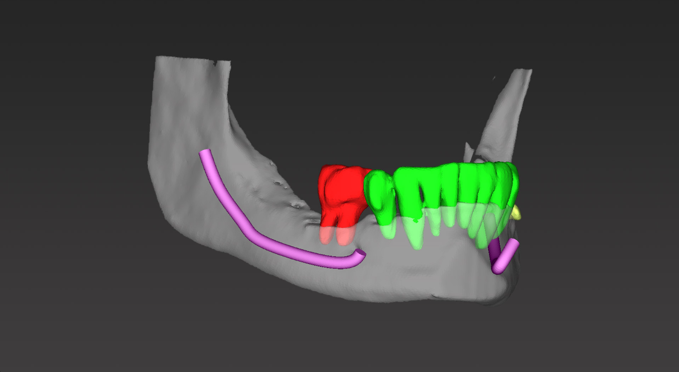 Metaverse Dentistry: Integrating Virtual Reality into Oral Care - 05